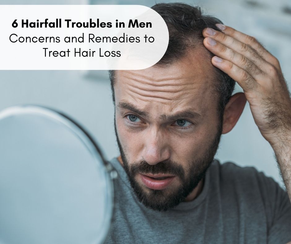 hair loss in men