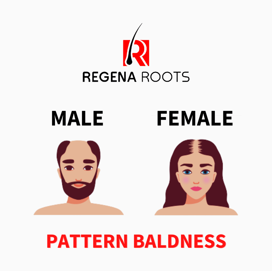 Female Pattern Balness