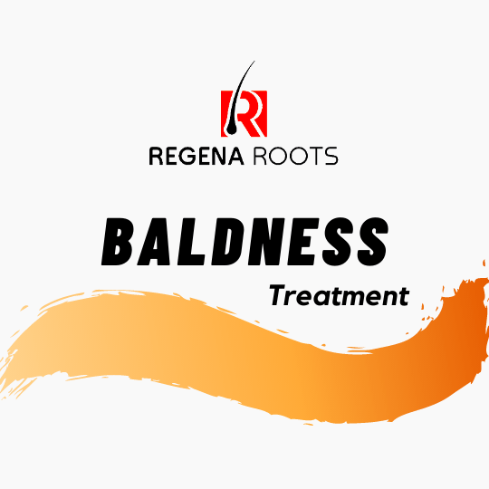 Natural Baldness Cure