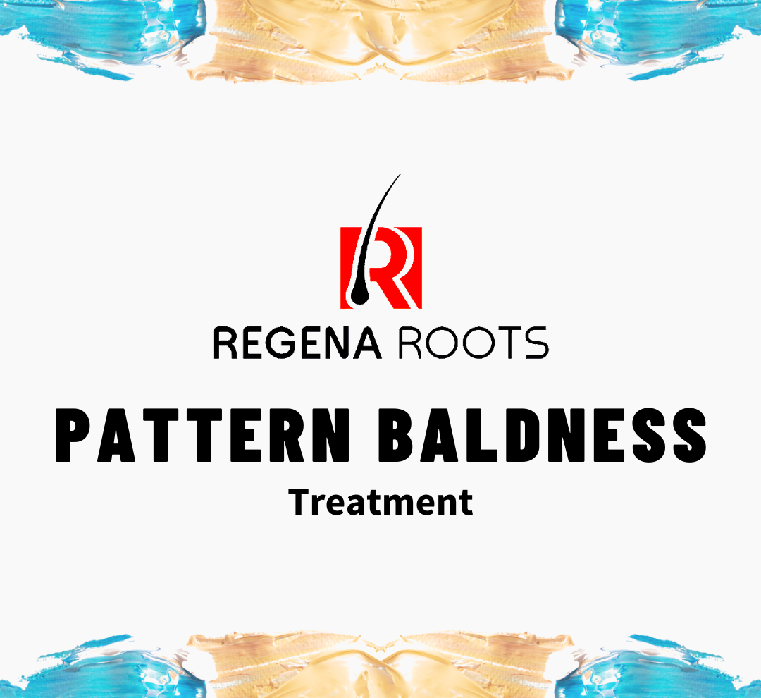 Pattern Baldness Treatment